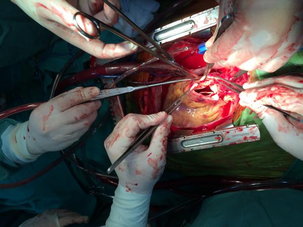 Cirugía Cardiaca y Pericárdica